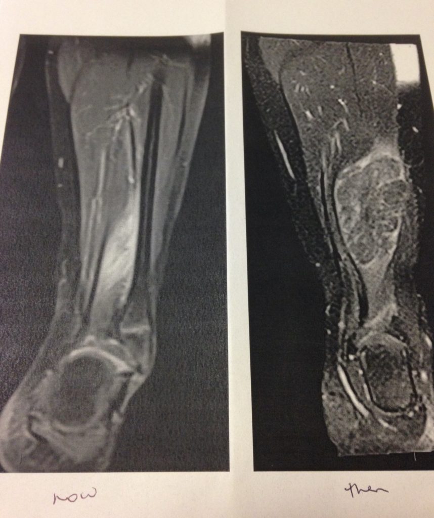 Before and after scans of Ruby's legs